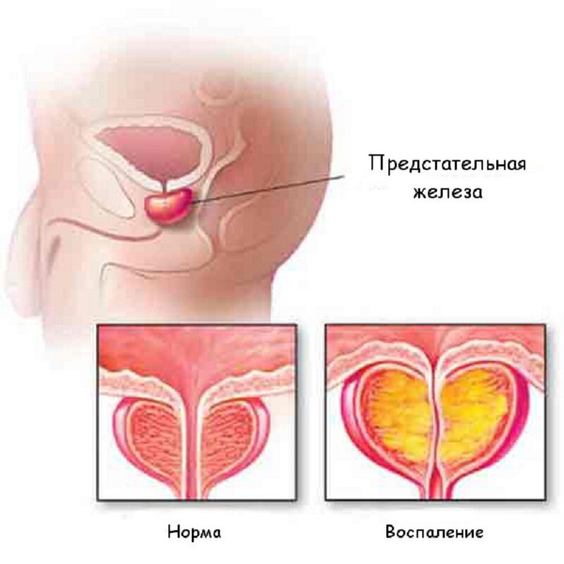 Эрекция - новые посты