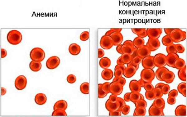 Препараты для повышения гемоглобина