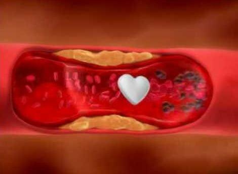  Кардиомагнил при беременности 1,2,3 триместр помогают улучшить кровоток