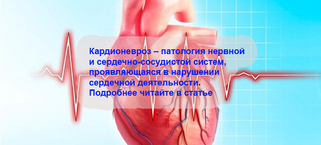 Сердцебиение неприятное ощущение. Невроз сердца. Кардионевроз. Невроз сердечно-сосудистой системы. Кардиологический невроз.