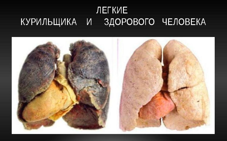 Легкие курильщика и здорового человека