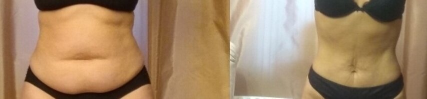 и кстати,


вот так худеешь, худеешь, а потом делаешь фото и понимаешь, что ты все еще толстый
уже не жирный, но толстоват
поэтому у меня сейчас типа челлендж на 8 дней
каждый день 100 приседаний и 100 пресса
100 приседаний я уже сделала, 2 раза по 50 и думаю, что надо видимо добавлять третий подход
так что челлендж тут же меняется, 150 приседаний и посмотрим сколько я осилю пресса, 100 я делаю легко кстати
пресс надо делать на верхнюю его часть и на нижнюю, это в идеале
