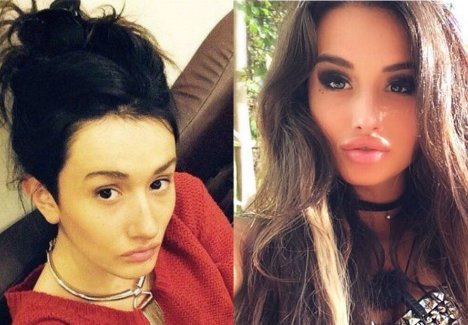 Девушка сделала пластическую операцию. Анжелина джоли пластические операции. Девушка сделала пластическую операцию. Девушка сделала пластическую операцию. Анжелина джоли до пластической операции.