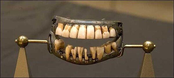 Родные зубы или фарфоровые коронки? Что в итоге победит?