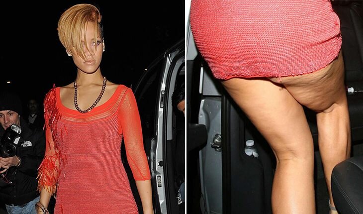 Самые страшные ноги голливудских красавиц