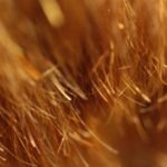 Дефект также имеет название трихоптилоз — это знакомые всем посеченные кончики. Фактором для развития выступает сухая форма себорейного дерматита. Результат – безжизненные локоны, лишенные живого блеска.