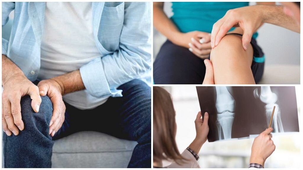 Чаще всего боль в суставах проявляется в коленях.