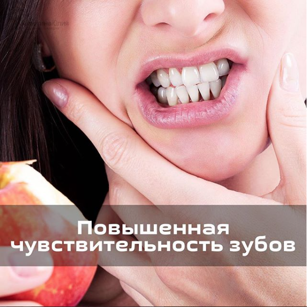 Повышенная чувствительность зубов. Повышенной чувствительности зубов. Сильная чувствительность зубов