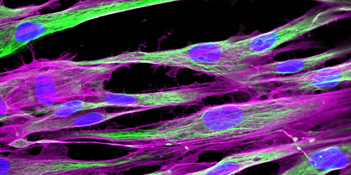 Волокна человеческого коллагена под микроскопом