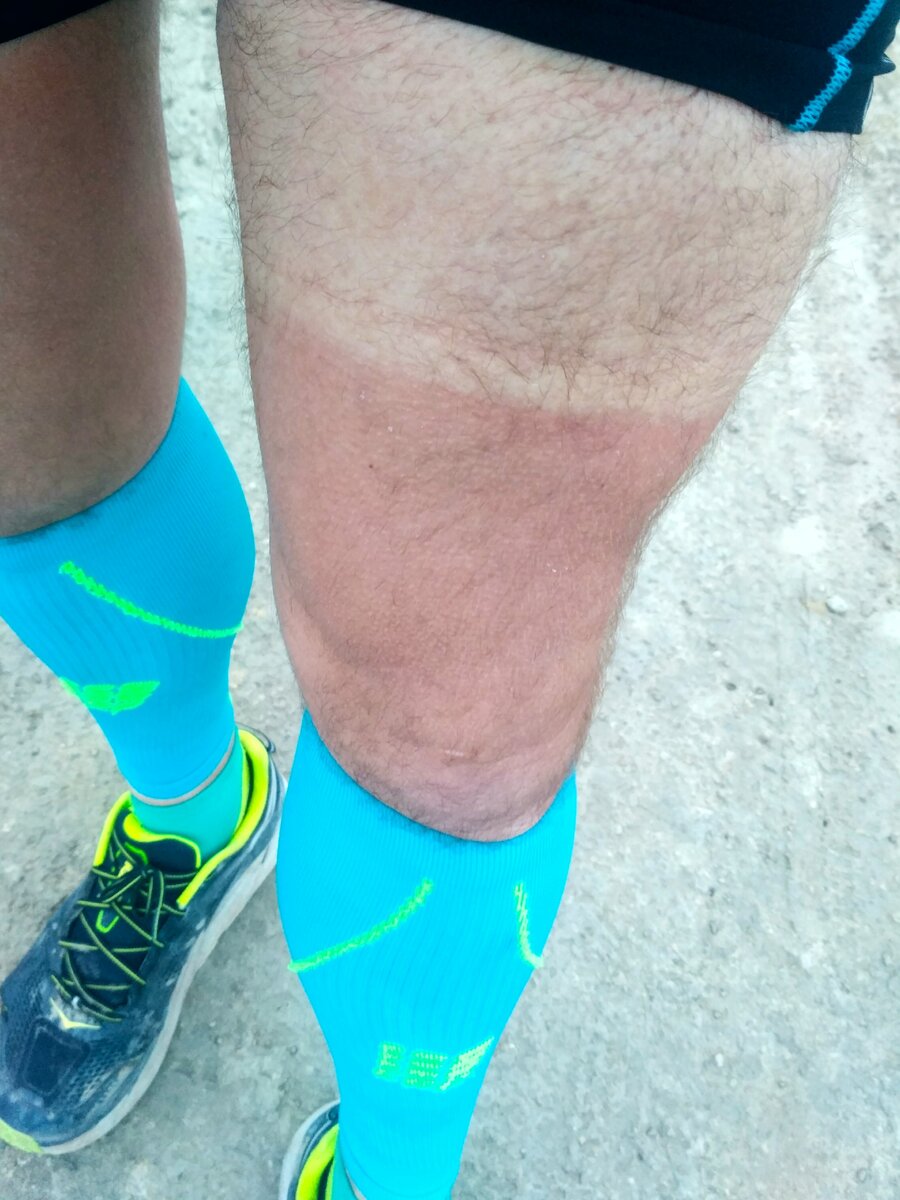 Для такого загара хватило 1 дня