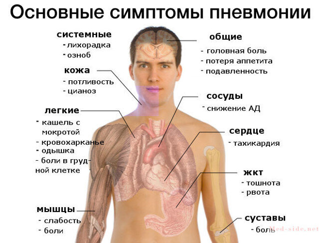 Степени поражения легких: КТ1, КТ2, КТ3, КТ4