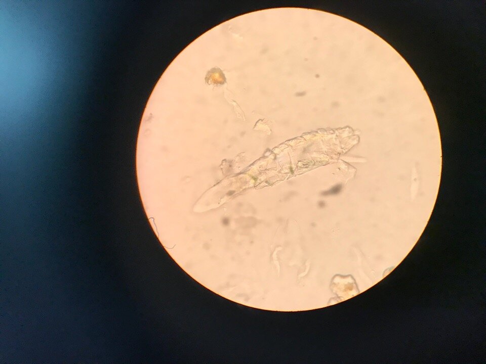 Яйца демодекса под микроскопом фото
