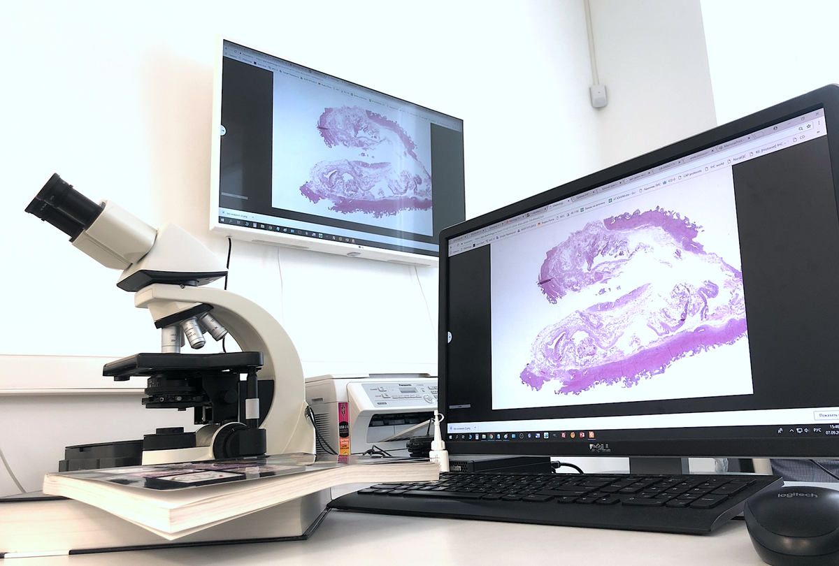 Сканы гистологических стекол.Окраска: гематоксилин и эозин. Увеличение Х20.