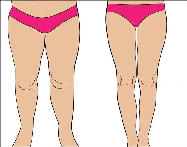 «Низовая азиатская система похудения за 10 дней»: Диета + упражнения для женщин