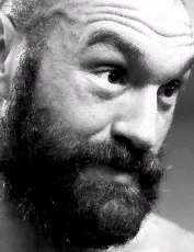 Прозвище: The Prince Весовая категория: супертяжёлый вес
Дата рождения: 01.06.1988 (31 год)
Место рождения: Манчестер, Англия
Место жительства: Уилмслоу, графство Чешир, Англия
Страна: Великобритания
Боевая стойка: правша
Рост: 206 см
Размах рук: 216 см
