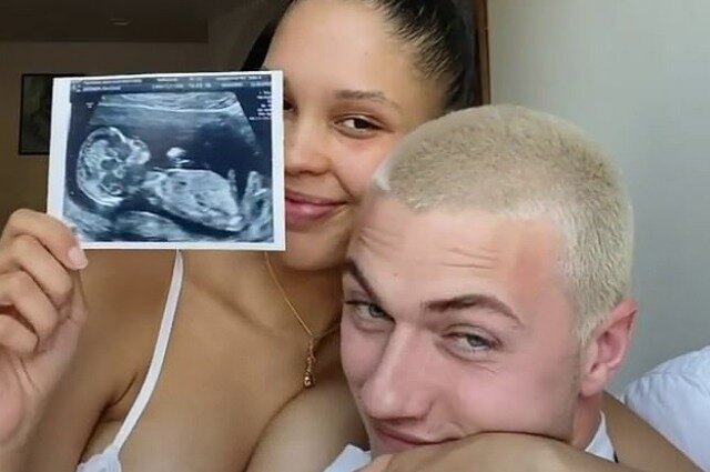 Фото УЗИ будущего ребёнка Нары Пеллман и Лаки Блю. Фото взято из открытых источников