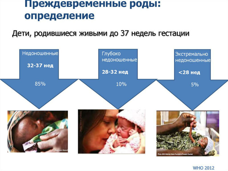 Преждевременные роды сроки в неделях таблица
