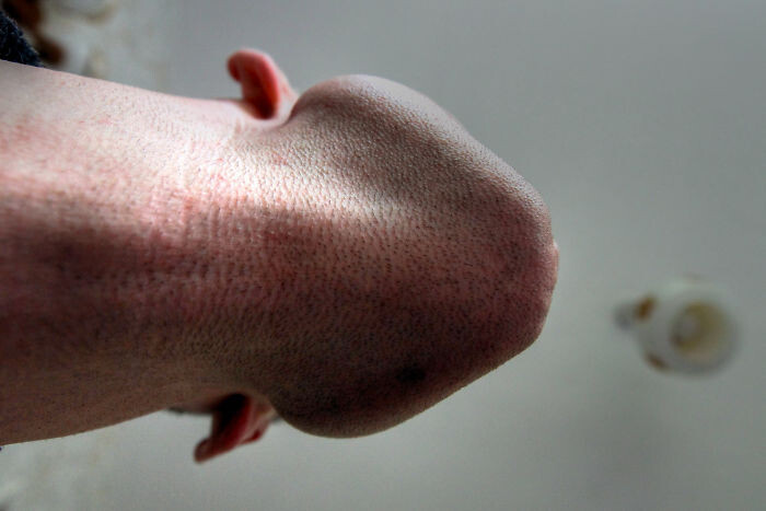 -2