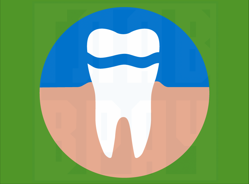   Не секрет, что с возрастом зубы у человека становятся менее устойчивыми и здоровыми на внешний вид. Появляется множество проблем. И одна из самых частых – это кариес.-2