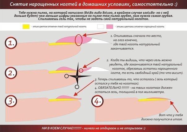 Лечение вросшего ногтя в Хабаровске