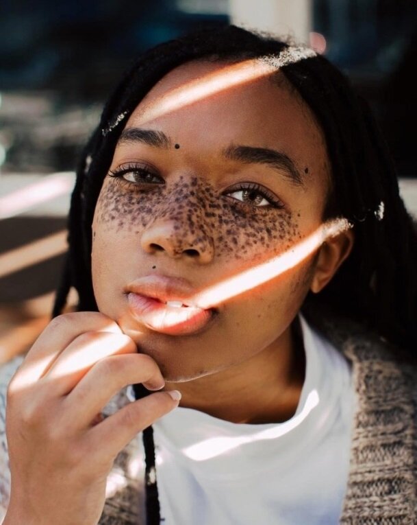 Красота в глазах смотрящего. Она смогла полюбить себя и стать популярной