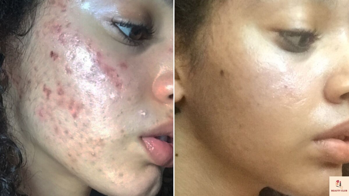 Подпишитесь на канал и поставьте лайк! Это поможет развитию канала. Заранее спасибо!