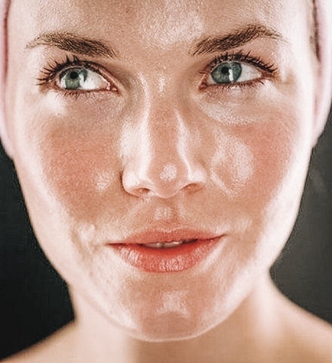 Жирная кожа.