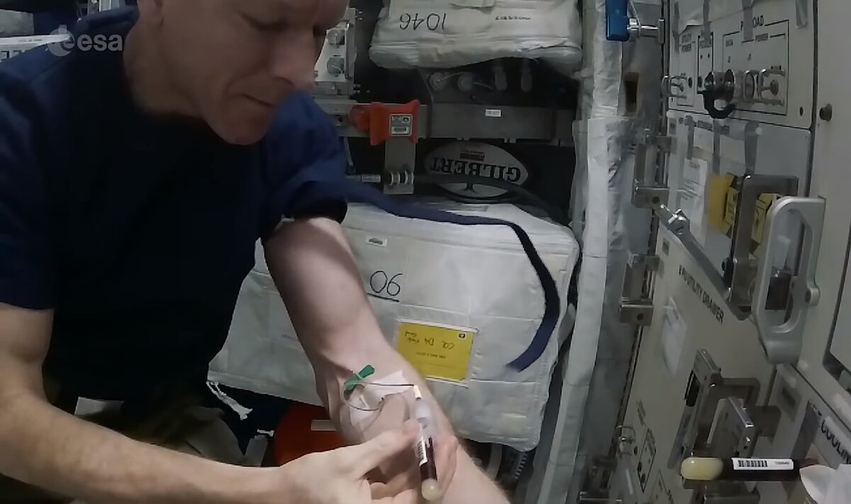 Британский астронавт Тим Пик в ролике ESA показывает, как делается забор крови. 
На фото видно иглу (зеленая), трубку и колбу с кровью