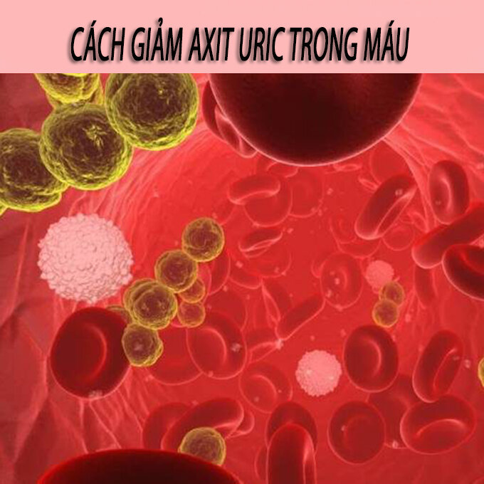 https://chuanroi.vn/wp-content/uploads/2018/10/cach-giam-axit-uric-trong-mau-tu-nhien-bang-che-do-an-uong.jpg
