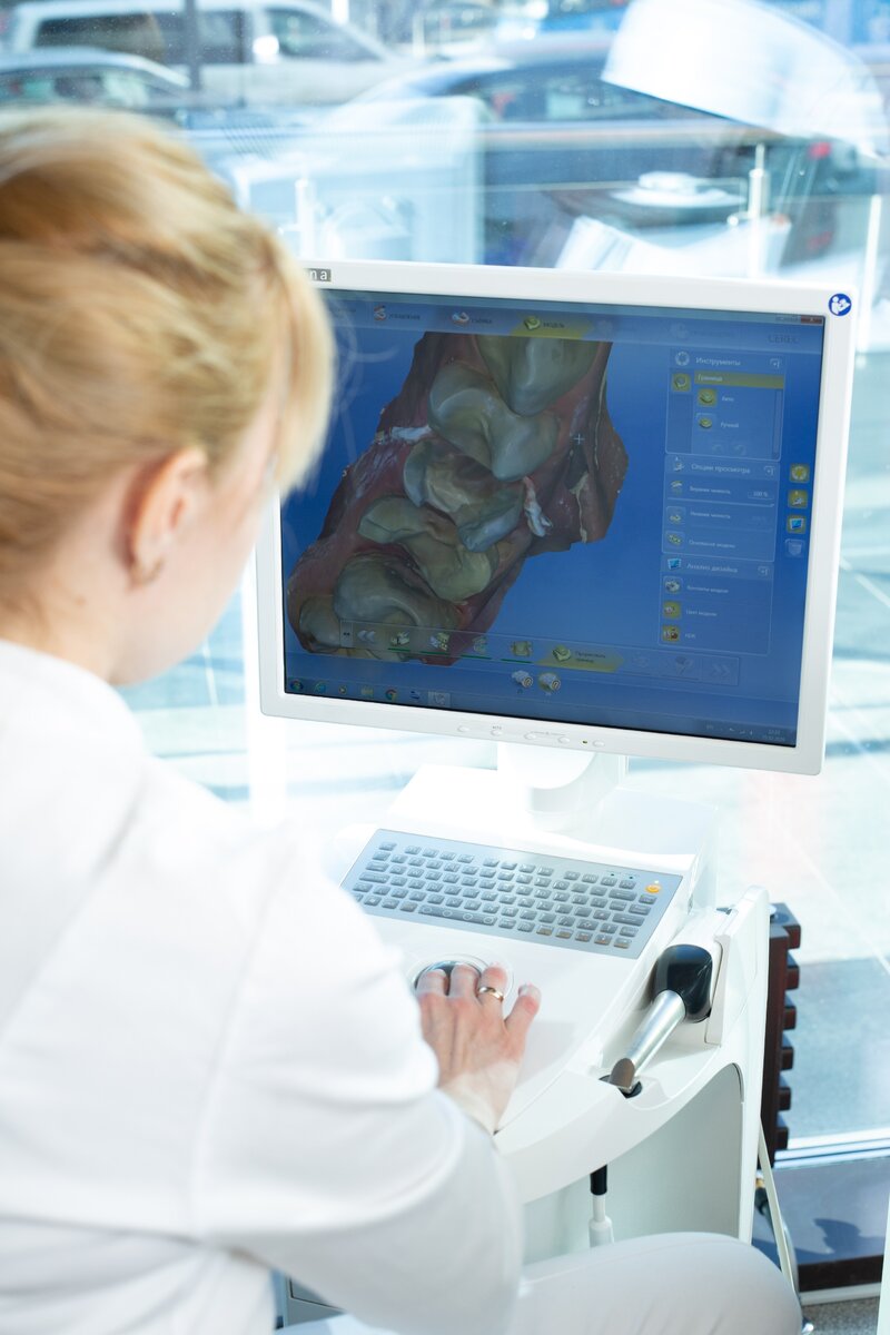 Так выглядит внутриротовой сканер. Вместо слепков - очень удобно и наглядно