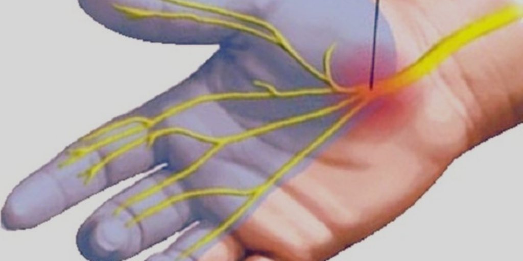 Онемение пальцев.