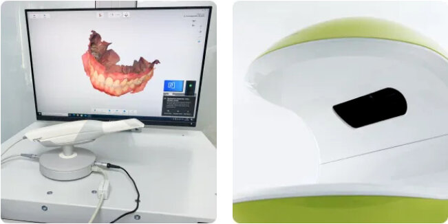 1 - Внутриротовой сканер; 2 - Оптический 3D-сканер