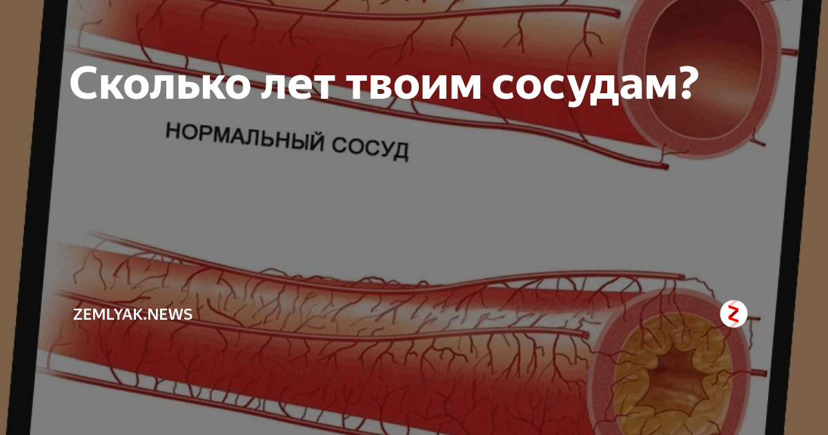 Жесткость сосудистой стенки