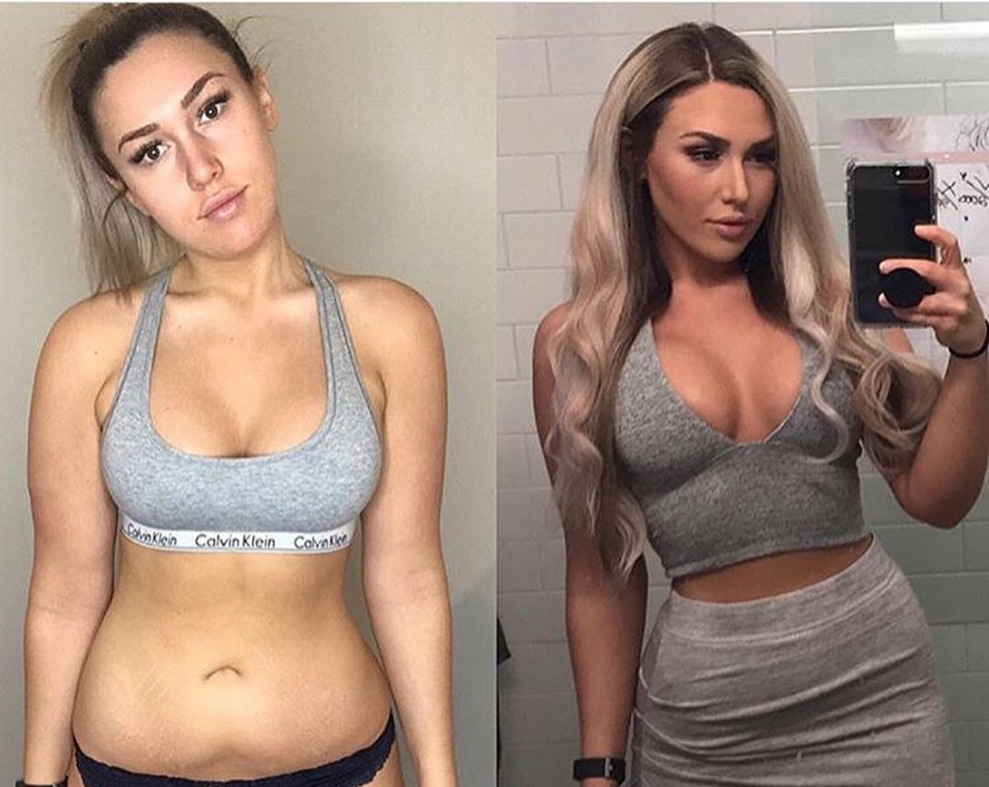фото до после девушки 
