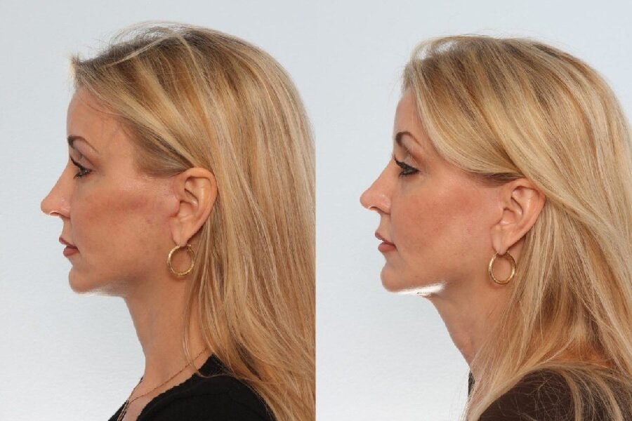 источник изображения - группа в ОК https://ok.ru/group55182152761552