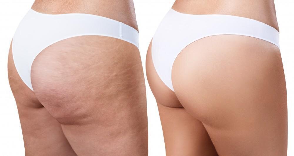 фото взято с сайта https://massagegold.ru/