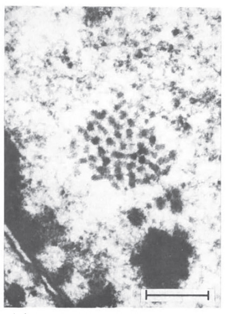 Рис. 1. Фотография из статьи – микрофотография эпителия с кластером вирусных частиц