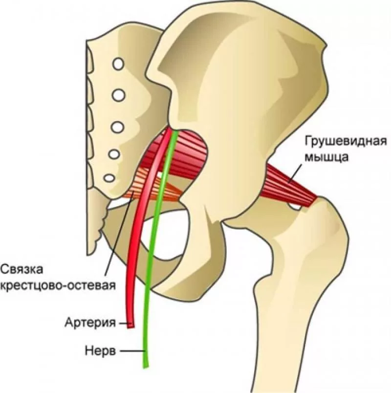 Прямая мышца бедра триггерные точки