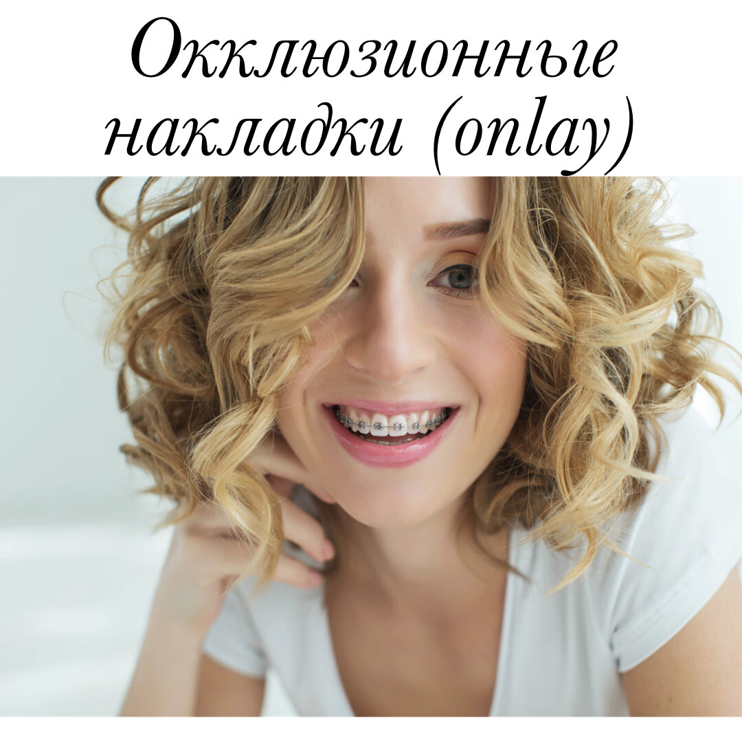 виниры, стоматология, москва, стоматолог, отродонт, брекеты, зубы, пульпит, парадонтит,парадонтоз, лечени зубов, отбеливание зубов, протезирование зубов, импланты, штифт, пломбы, пломбирование, виниринг, здоровье, красота,косметология, красивая углыбка, улыбка, голливудская улыбка 