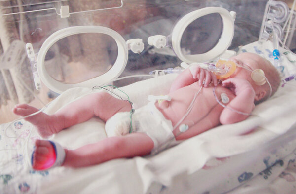 Младенец в инкубаторе, 34 недели (фото Sharon McCutcheon)