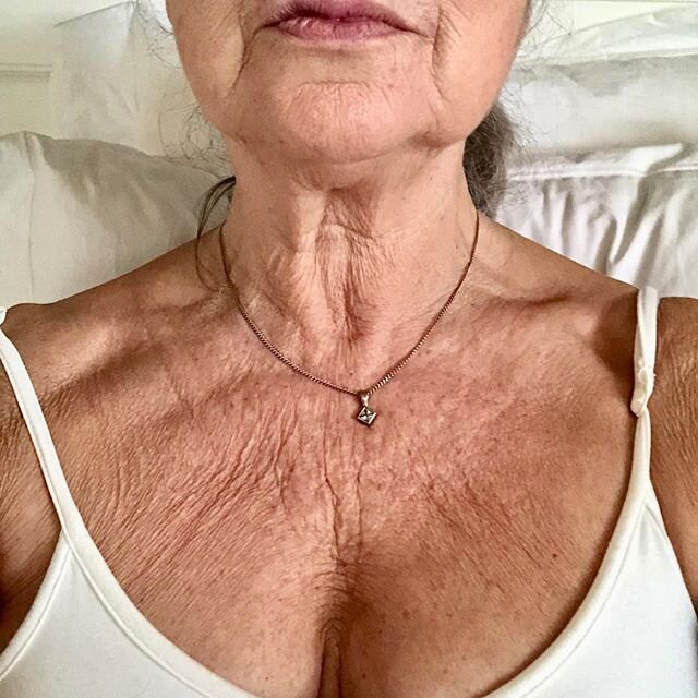 Дряблая кожа на шее - признак старости