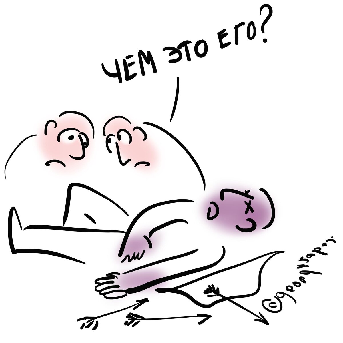 Синдром лучника