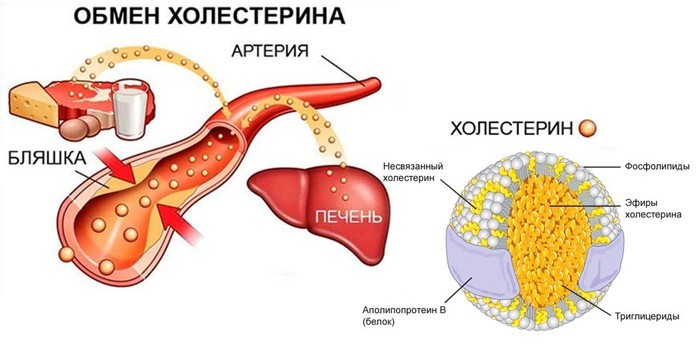 Повышенный холестерин отзывы врачей