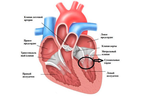 Дополнительная хорда в сердце