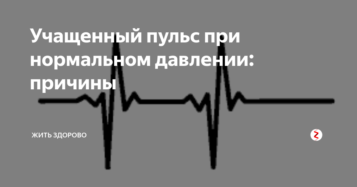 Учащенный пульс при повышенном давлении