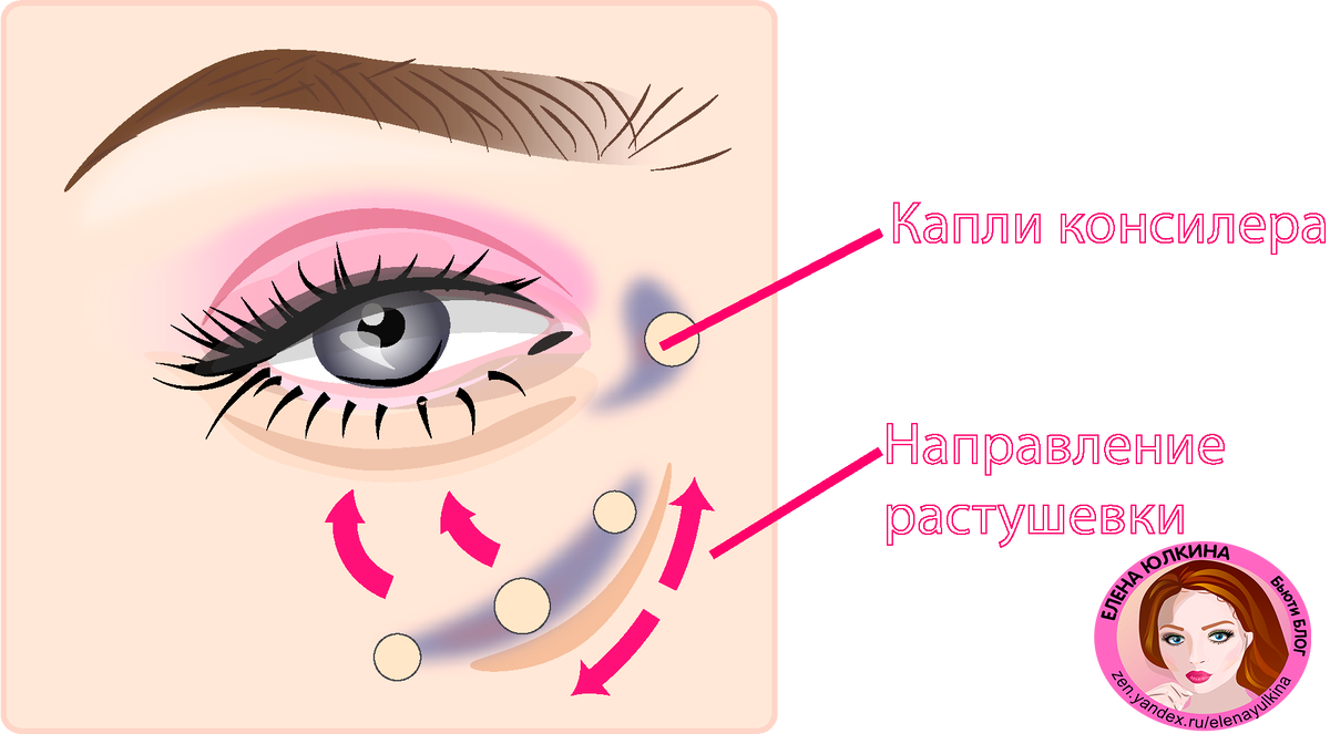 синяки под глазами какого витамина не хватает. круги под глазами причины. девушка с мешками под глазами. синяки под глазами какого витамина не хватает. упражнения от синяков под глазами.