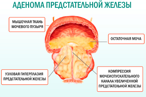 фото: фото: http://medic.ua