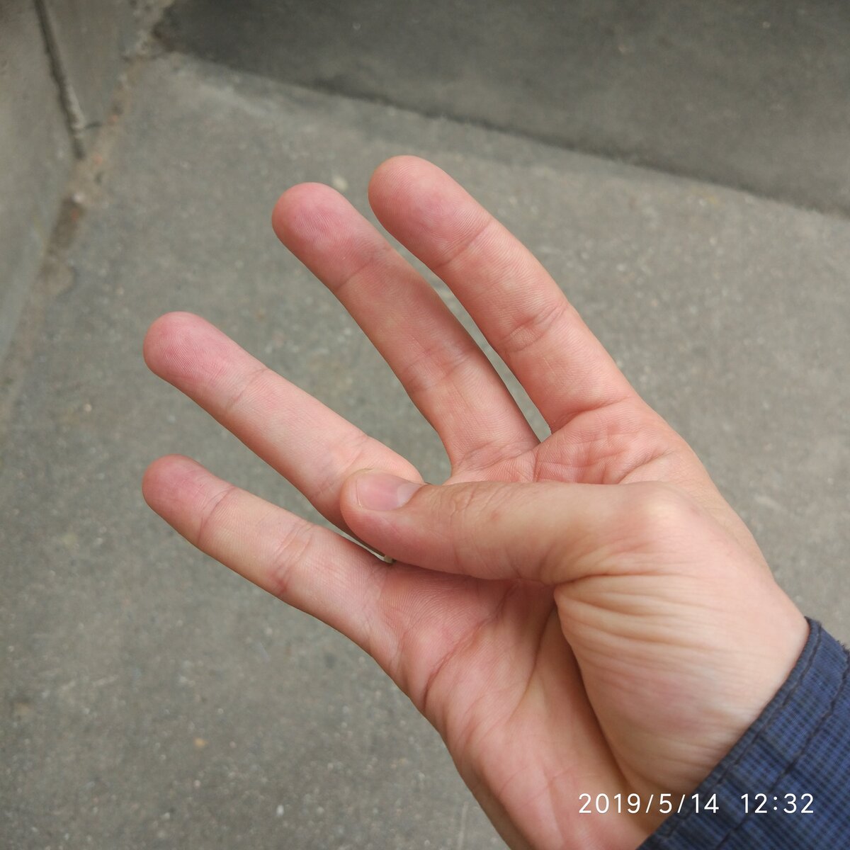 -2