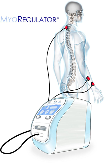 Разрабатывается новая неинвазивная терапия последствий инсульта 