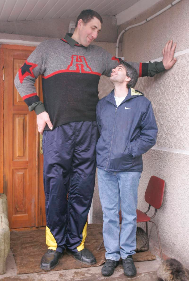 Гигантизм Леонида не  врожденный, а приобретенный – он стал расти после перенесенной в  возрасте двенадцати лет операции на мозге, в результате которой  развилась опухоль гипофиза. Стадник не желал шумихи вокруг своего имени,  поэтому долгое время отказывался от услуг представителей книги рекордов  Гиннесса. По некоторым данным рост его составлял 253 см. В 2014 году  Стадник умер от геморрагического инсульта.